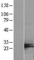 C7orf50 Human Over-expression Lysates NM_001134396