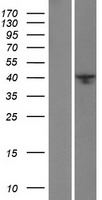 BRMS1L Human Over-expression Lysates NM_032352