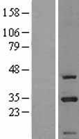 CIP29 (SARNP) Human Over-expression Lysates NM_033082