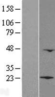 ls084328 lzic human over expression lysates nm 032368 wb testing 1