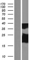 ls084332 dydc2 human over expression lysates nm 032372 wb testing 1