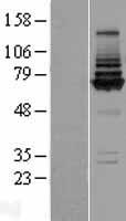 COG8 Human Over-expression Lysates NM_032382
