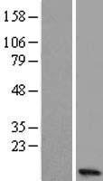 NMES1 (C15orf48) Human Over-expression Lysates NM_197955