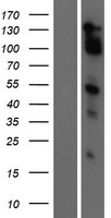 MAML2 Human Over-expression Lysates NM_032427