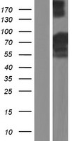 LZTS2 Human Over-expression Lysates NM_032429