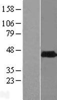 ls084457 phyhipl human over expression lysates nm 032439 wb testing 1