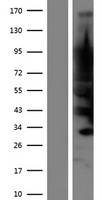 JPH4 Human Over-expression Lysates NM_001146028