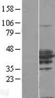 RHOXF2 Human Over-expression Lysates NM_032498