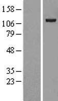USP38 Human Over-expression Lysates NM_032557