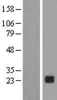 PLA2G12B Human Over-expression Lysates NM_032562