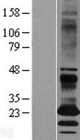 EBPL Human Over-expression Lysates NM_032565