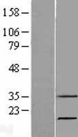 Ribonuclease 7 (RNASE7) Human Over-expression Lysates NM_032572