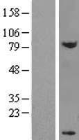 DPY30 Human Over-expression Lysates NM_032574