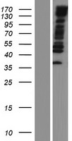ls084665 mypn human over expression lysates nm 032578 wb testing 1