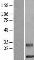 RELM beta (RETNLB) Human Over-expression Lysates NM_032579