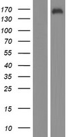 KDM2B Human Over-expression Lysates NM_032590