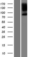 ls084687 ppp1r9b human over expression lysates nm 032595 wb testing 1