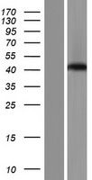 SPATA22 Human Over-expression Lysates NM_001170696