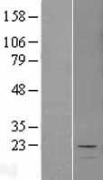 MCEE Human Over-expression Lysates NM_032601