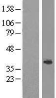 ls084696 abhd1 human over expression lysates nm 032604 wb testing 1
