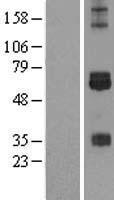 CREB3L3 Human Over-expression Lysates NM_032607