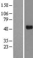GTPBP3 Human Over-expression Lysates NM_032620