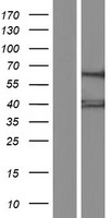 ls084705 gtpbp3 human over expression lysates nm 133644 wb testing 2