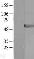 GPT2 Human Over-expression Lysates NM_133443