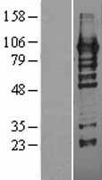 ls084717 hrp2 hdgfrp2 human over expression lysates nm 032631 wb testing 1