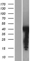 PSRC1 Human Over-expression Lysates NM_032636