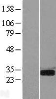 SPSB2 Human Over-expression Lysates NM_032641