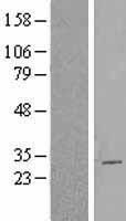 ls084733 cbx2 human over expression lysates nm 032647 wb testing 2