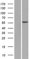USP30 Human Over-expression Lysates NM_032663