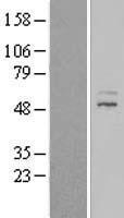 ZNF577 Human Over-expression Lysates NM_032679