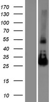 NAA11 Human Over-expression Lysates NM_032693