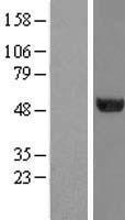 TUBA6 (TUBA1C) Human Over-expression Lysates NM_032704