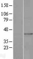 MAG1 (GPAT3) Human Over-expression Lysates NM_032717