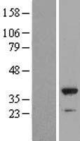 NFKBID Human Over-expression Lysates NM_139239