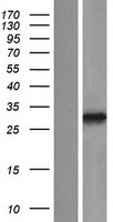 PPAPDC3 (PLPP7) Human Over-expression Lysates NM_032728