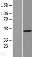 RTN4IP1 Human Over-expression Lysates NM_032730