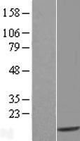 TXNDC17 Human Over-expression Lysates NM_032731