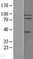 IL17RC Human Over-expression Lysates NM_153461