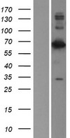 Lamin B2 (LMNB2) Human Over-expression Lysates NM_032737