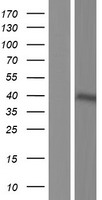 FCRLM1 (FCRLA) Human Over-expression Lysates NM_001184867