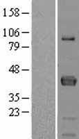 FCRLM1 (FCRLA) Human Over-expression Lysates NM_032738
