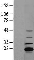 ADTRP Human Over-expression Lysates NM_032744