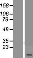 ls084833 atp5md human over expression lysates nm 032747 wb testing 1