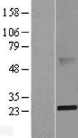 ls084836 abhd14b human over expression lysates nm 032750 wb testing 1