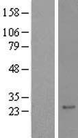QRX (RAX2) Human Over-expression Lysates NM_032753