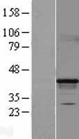 HPDL Human Over-expression Lysates NM_032756